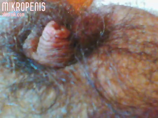 mikropenis