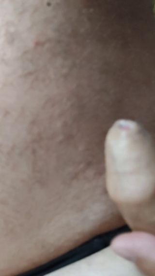 aigel75