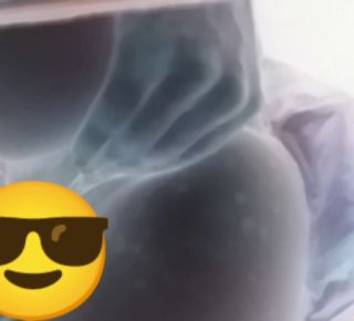 👄🤨1