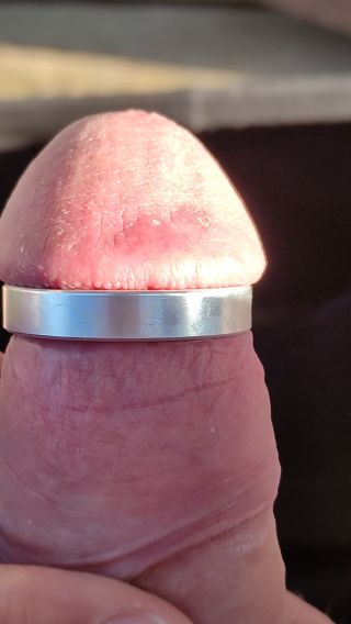 zabawa_anal