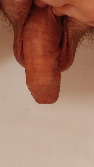 Max_fister