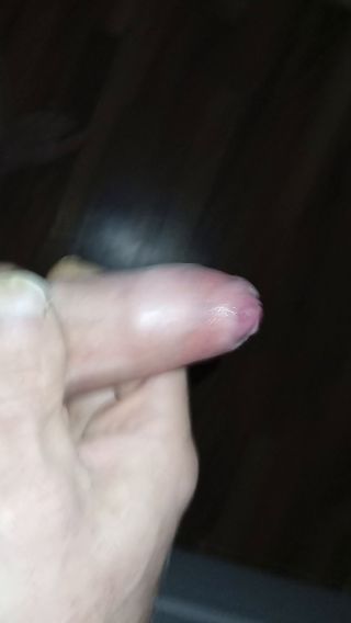 Xxxxf